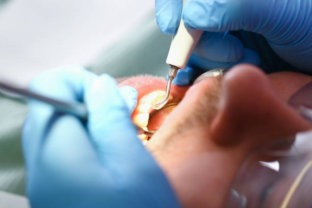 Best Emergency Dental Surgery in Green Springs, OH