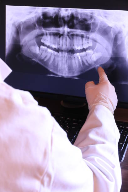 Best Emergency Wisdom Teeth Removal in Green Springs, OH